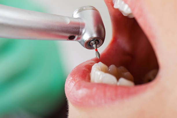 Best Emergency Dental Care for Broken or Chipped Teeth in Gardnerville Ranchos, NV